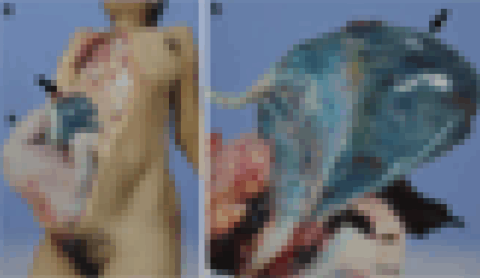 【閲覧注意】妊娠中の女性が見てはいけない画像、ヤバすぎる