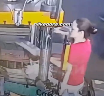 【閲覧注意】工場の女性作業員、一瞬で体の一部が ”1cm” になってしまい絶望…（動画あり）