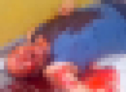 【閲覧注意】腹に穴が空いた人間の死に方がヤバい…人間ポンプかよ…（動画あり）