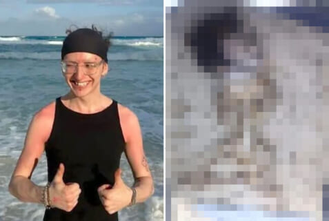 【閲覧注意】海で溺れる人を救おうとした勇敢なアメリカ人、サメに食われて無惨な姿に…