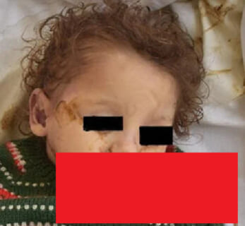 【閲覧注意】2歳の子供が死亡した瞬間、体内から「殺人生物」が出てくる画像、怖すぎだろ…