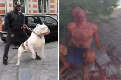 【閲覧注意】ブラジルの泥棒、ピットブルに顔をズタズタにされ精神崩壊…（動画あり）