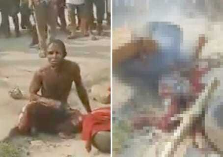 【閲覧注意】もう100％助からないのに体だけが生きようとしてる人間の動画…