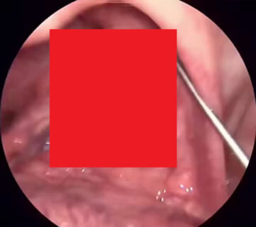 【閲覧注意】口臭ヤバい奴の口の中、100％「コレ」があるらしいな…（動画あり）