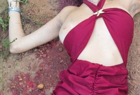 【閲覧注意】10代♀立ちんぼ、街中でおっぱい丸出しでこうなって発見される（画像あり）