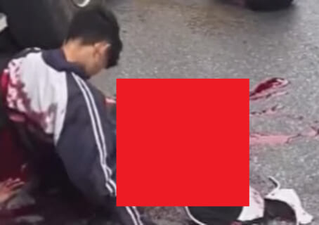 【閲覧注意】原付で事故った高校生、自分の下半身を見てはいけなかった・・・（動画あり）