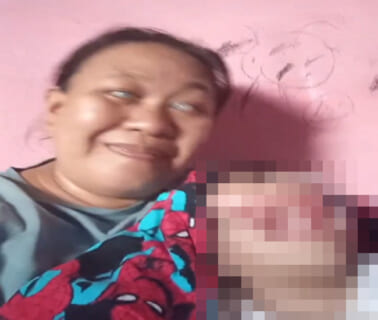 【閲覧注意】重度障害者の女性が「娘の顔」を公開。闇が深すぎると話題に