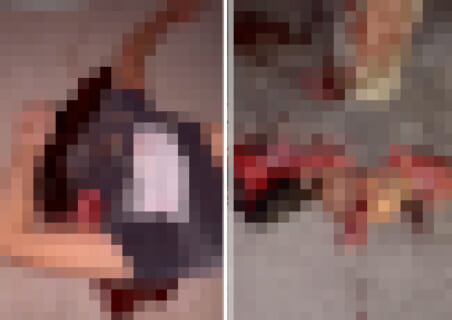 【超！閲覧注意】事故現場で顔が70cmに伸びた人間が発見される…嘘だろ…（動画あり）