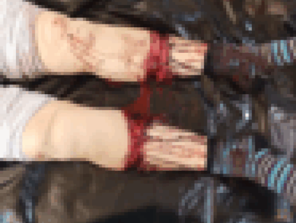 【閲覧注意】女さん、カミソリで両足を切り続け死亡してしまう・・・（画像あり）