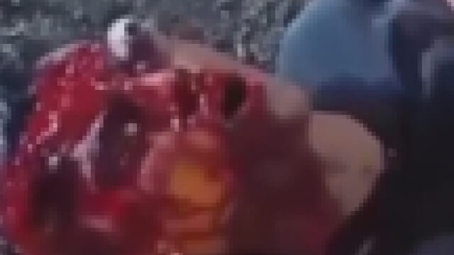 【超！閲覧注意】事故現場で目玉が飛び出たまま叫び続けてる少年が発見される…これはヤバすぎ…