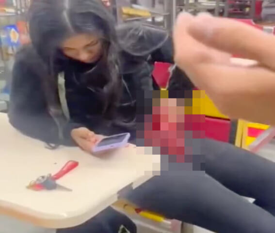 【閲覧注意】コンビニに内臓飛び出した女の子が普通におるんやが…ちょっとこれ見てくれ…
