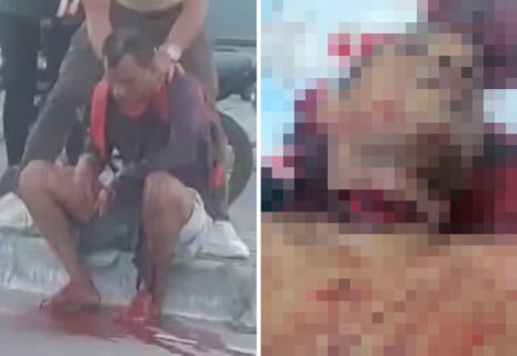 【閲覧注意】バイクがよく通る道に ”首刈りワイヤー” が張ってた結果…（動画あり）