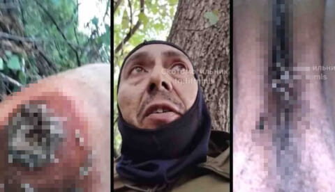 【閲覧注意】ウクライナ兵「あぁ…私の肛門を見てくれ。私は間違いなく死ぬだろう…」（動画あり）