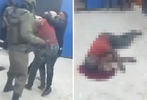 【閲覧注意】アフリカの逮捕現場がヤバい。容疑者が抵抗すると一瞬でこうなる（動画あり）