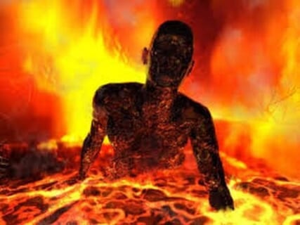 【閲覧注意】800℃の液体に落ちた工場作業員「ギャアアアア！！！」⇒ その後の姿が…