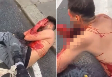 【超！閲覧注意】この男が血まみれになった理由がヤバい、お前らの想像の200倍はヤバい・・・（動画あり）