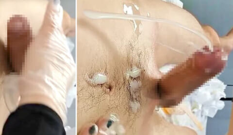 男性器脱毛クリニックの新人研修、うっかり男性客を2回も大量射精させてしまうｗｗｗ