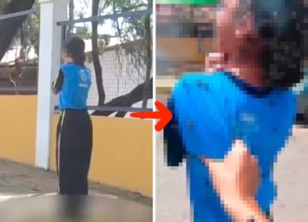 【閲覧注意】街中の女子高生「ギャアアア！」⇒ 近付いたら想像の10倍エグイ事になってた…