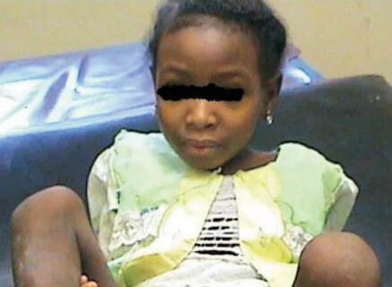 【閲覧注意】この部族幼女の下半身、ガチでヤバすぎると話題に・・・（画像あり）
