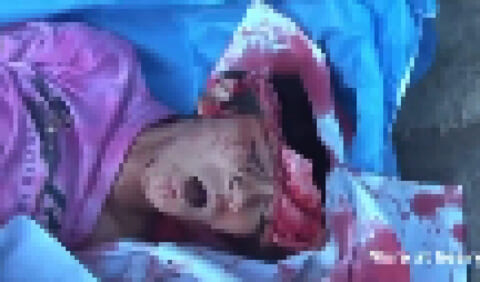 【超！閲覧注意】事故で脳みそが無くなった女の子が ”喋り出す” 動画、何度見ても怖い