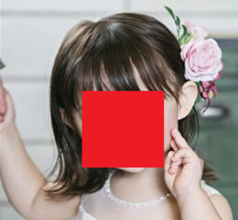 【閲覧注意】集合体恐怖症の人が見てはいけない5歳幼女の顔、さすがにヤバすぎる（画像あり）