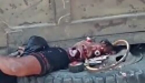 【閲覧注意】事故で５トンの重さでプレスされた人間はこうなる・・・エグすぎだろ・・・（動画あり）