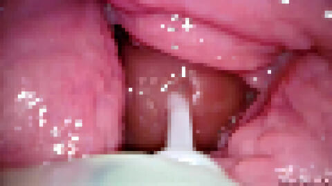【閲覧注意】この女性のマ○コから大量の精液が出てきたって怖すぎるだろ…（動画あり）