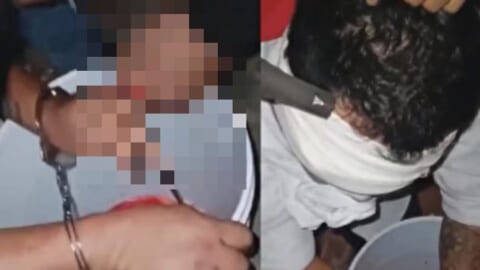 【閲覧注意】殺されるか「これに耐えるか」だったらどっち選ぶ？（動画あり）