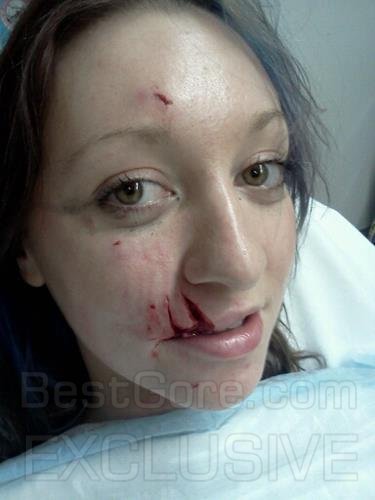 girl-bit-by-dog-in-face-best-gore-exclusive-03