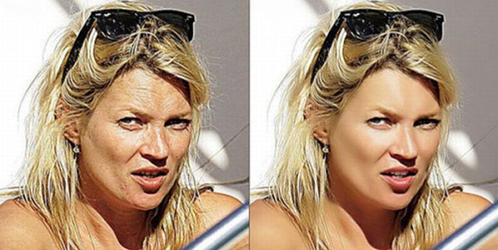 celebrity_photos_before_and_after_23