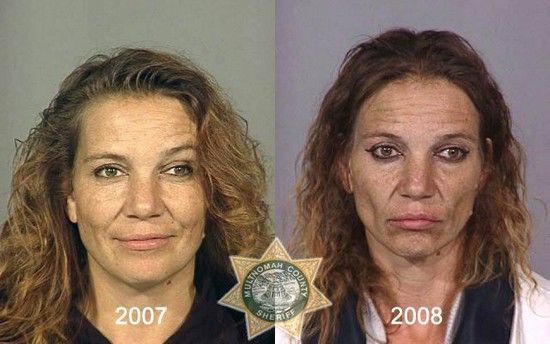 meth-addict-10