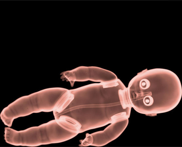 amazing_xray_artwork_640_10