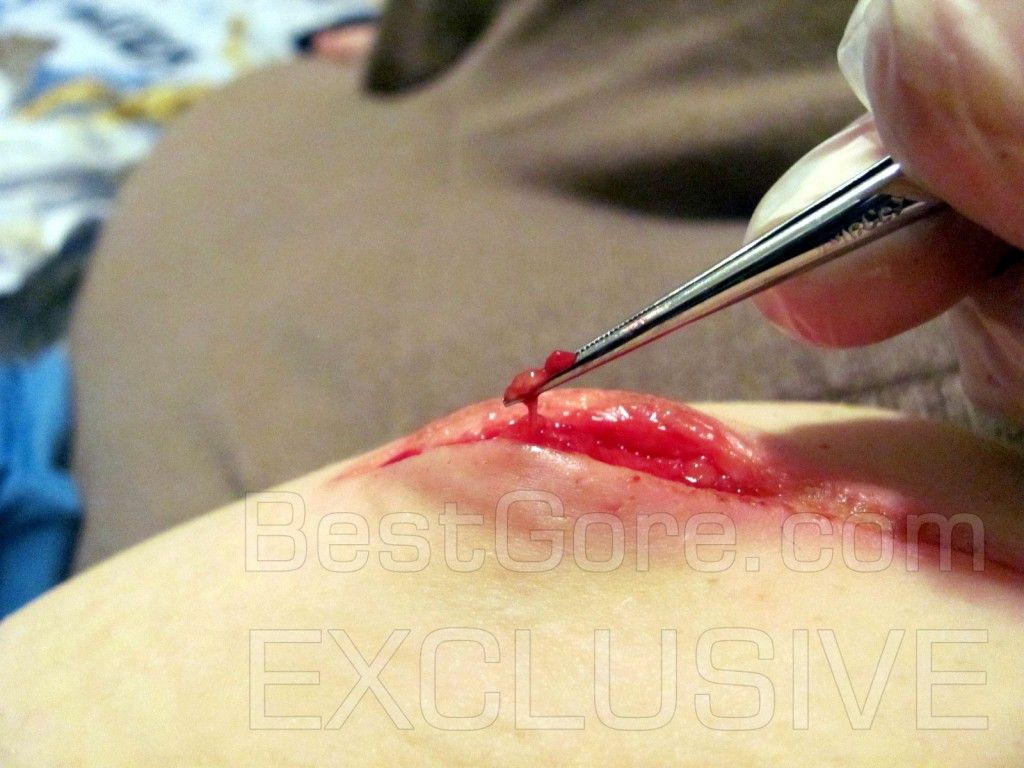 self-harmer-reveal-second-clit-best-gore-exclusive-16-1024x768