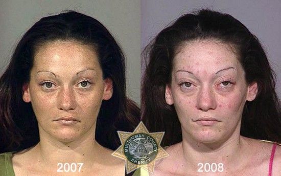 meth-addict-20