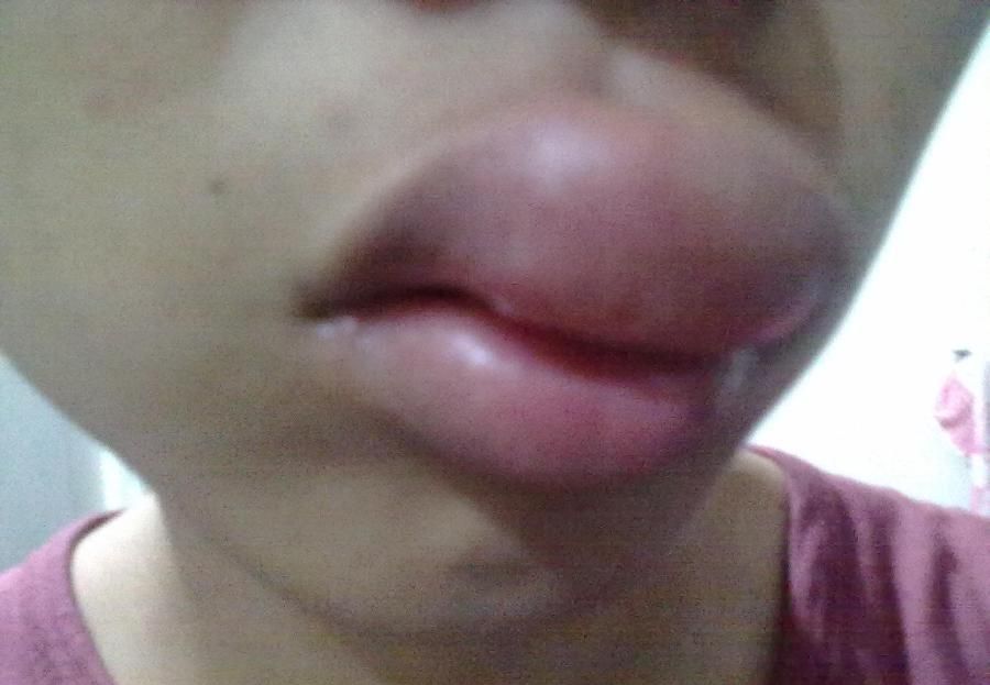 fat_lip_03