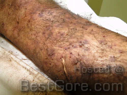 death-by-bee-stings-5000-brazil-03