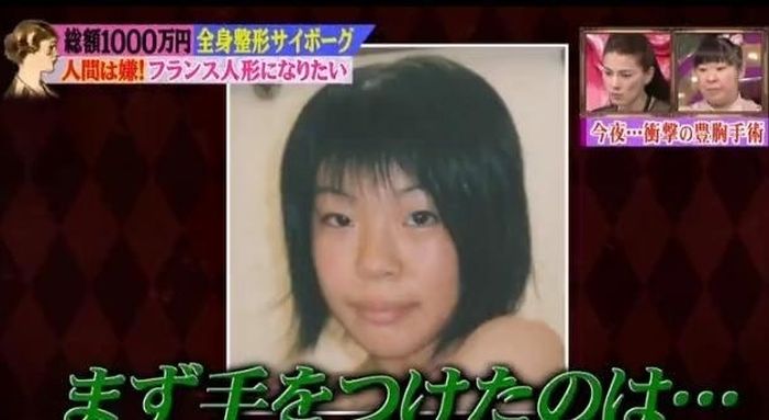 japanese_woman_gets_plastic_surgery_01