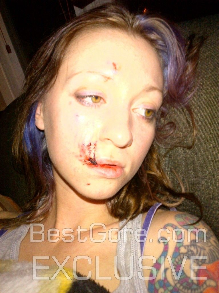 girl-bit-by-dog-in-face-best-gore-exclusive-07-768x1024