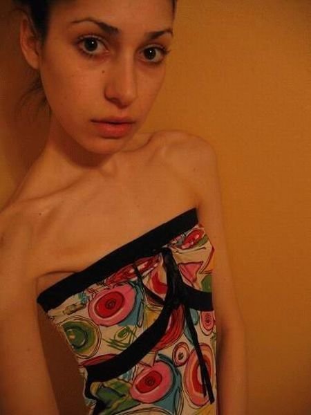 ru_anorexia-021