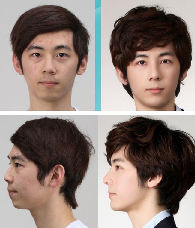 crazy_before_and_after_photos_of_korean_plastic_30
