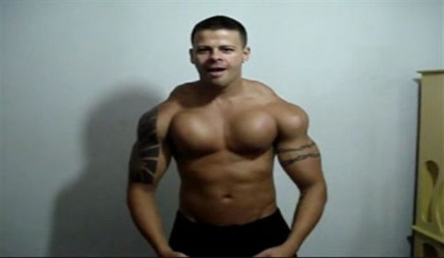 when_plastic_surgery_goes_really_wrong_640_01