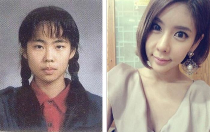 crazy_before_and_after_photos_of_korean_plastic_22