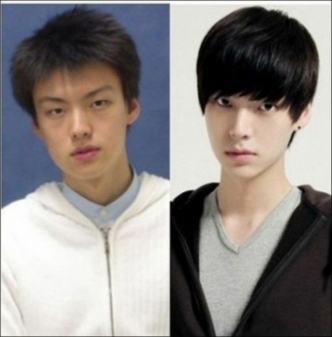 crazy_before_and_after_photos_of_korean_plastic_02