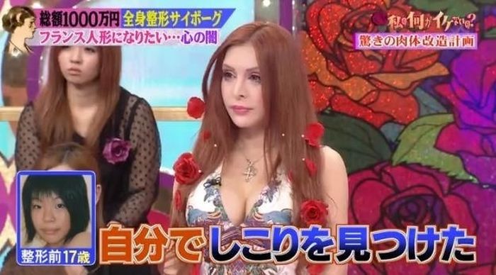 japanese_woman_gets_plastic_surgery_07