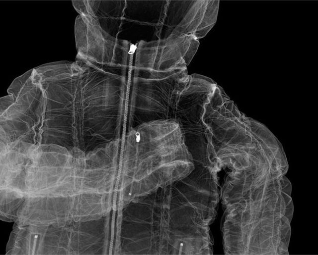 amazing_xray_artwork_640_31