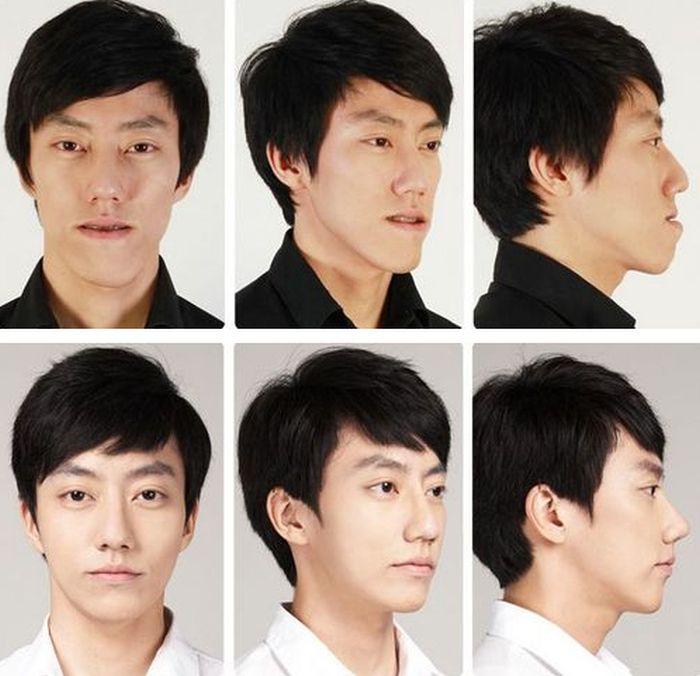 crazy_before_and_after_photos_of_korean_plastic_14