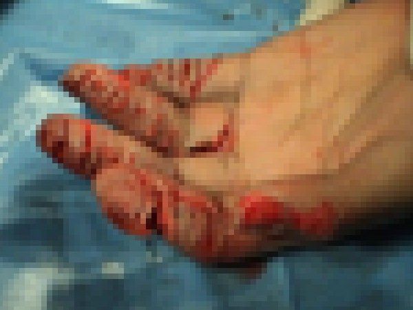 kako-fyrXPeiuCLUatkhG