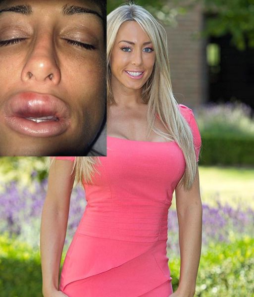 sometimes_beauty_treatments_just_make_you_ugly_640_18