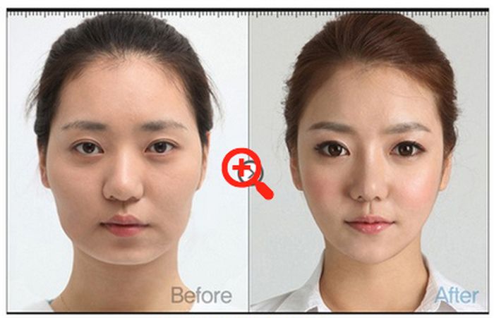 crazy_before_and_after_photos_of_korean_plastic_25