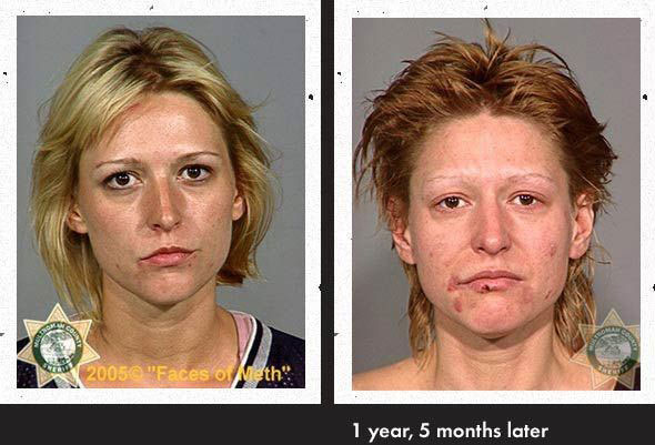 faces-of-meth-10